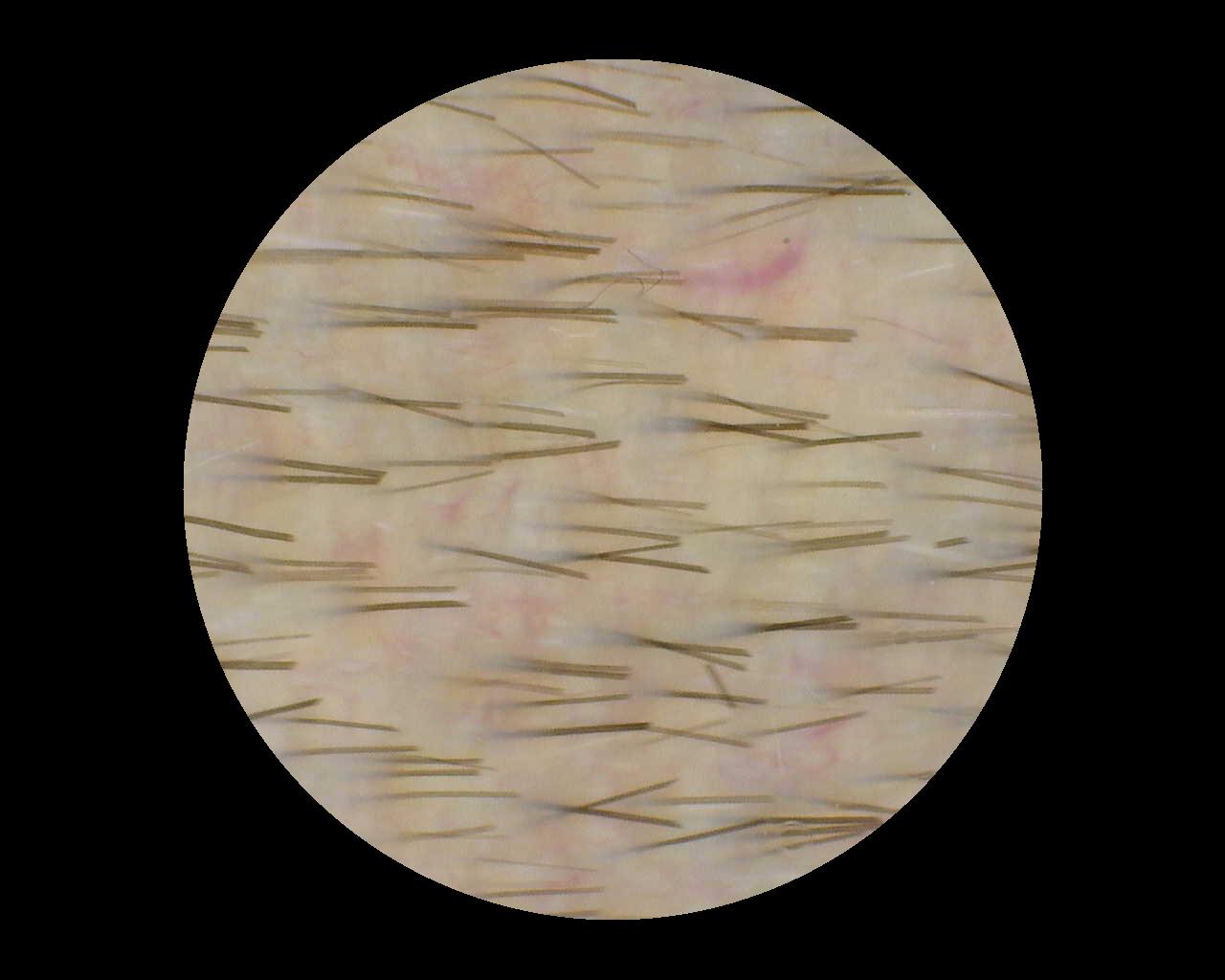 Beispielbild 5 für die TrichoScan-Analyse, aufgenommen mit Dino-Lite