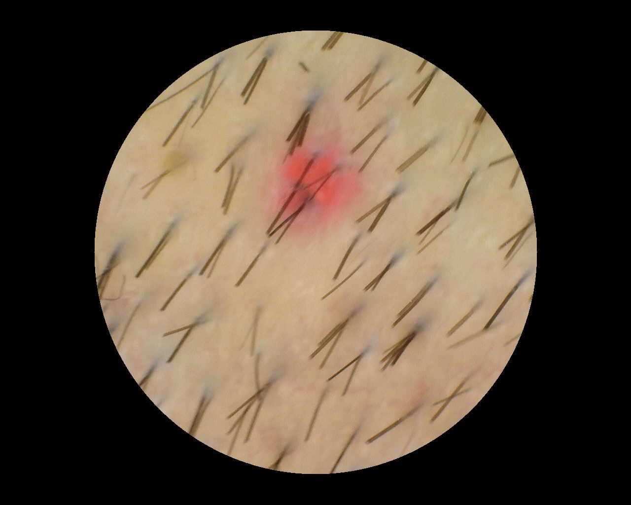 Beispielbild 6 für die TrichoScan-Analyse, aufgenommen mit Dino-Lite