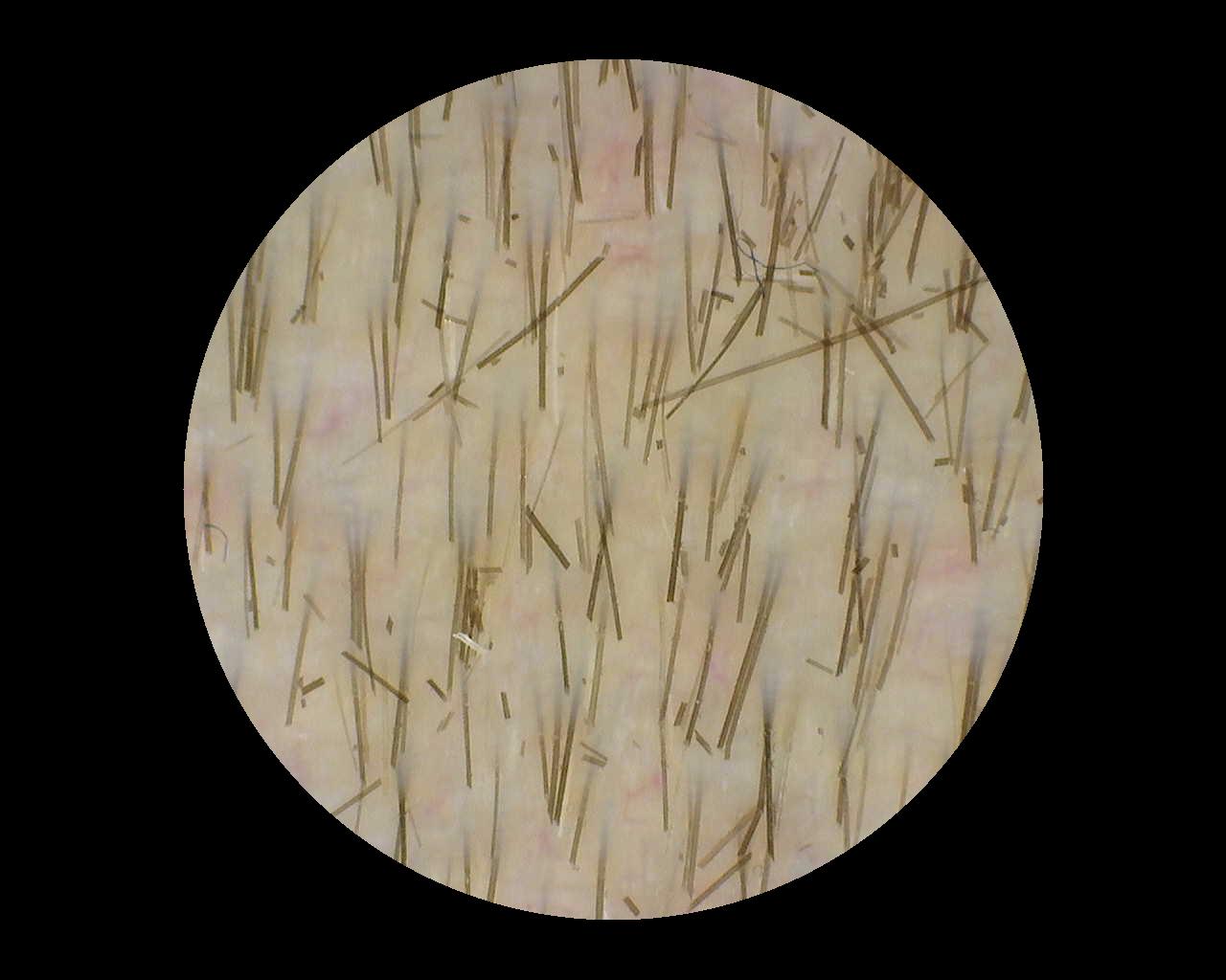 Ungeeignetes Beispielbild: störende Haarreste und quer verlaufende Haare