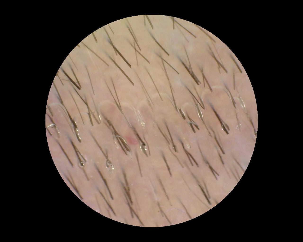 Ungeeignetes Beispielbild: Lufteinschlüsse und unscharfer Bildbereich