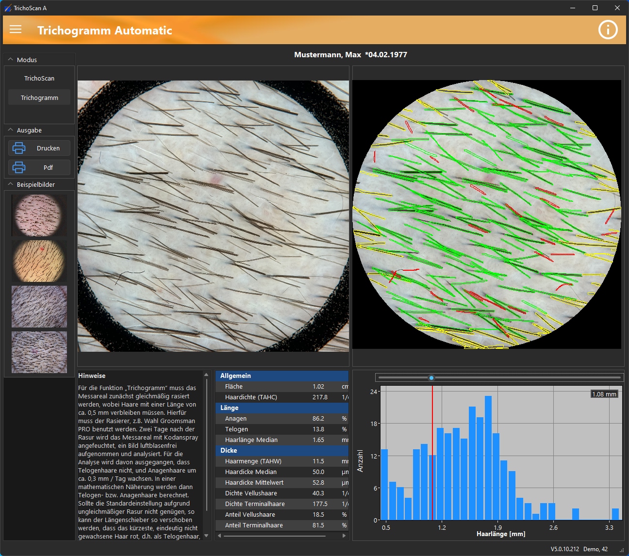 TrichoScan Screenshot 1
