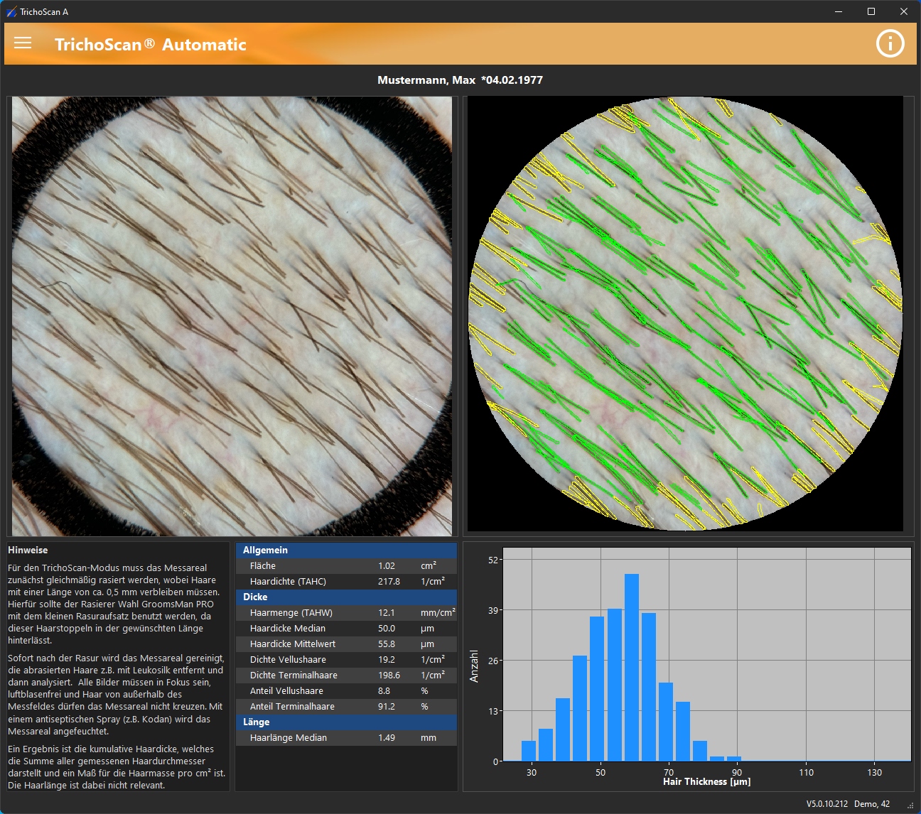 TrichoScan Screenshot 2