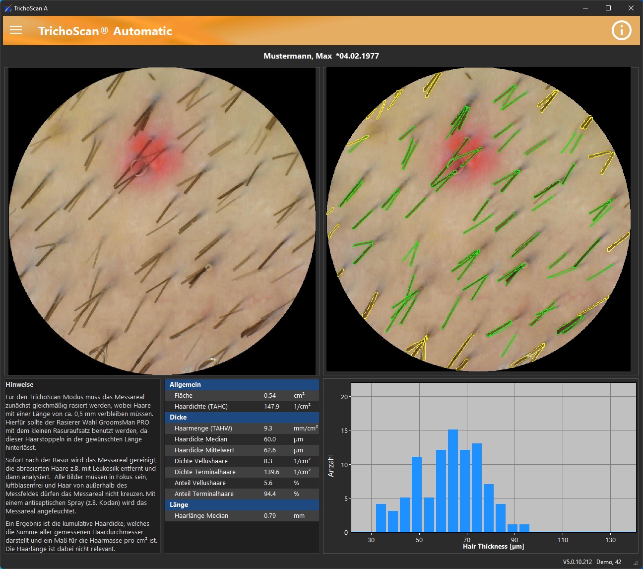 TrichoScan Screenshot 4