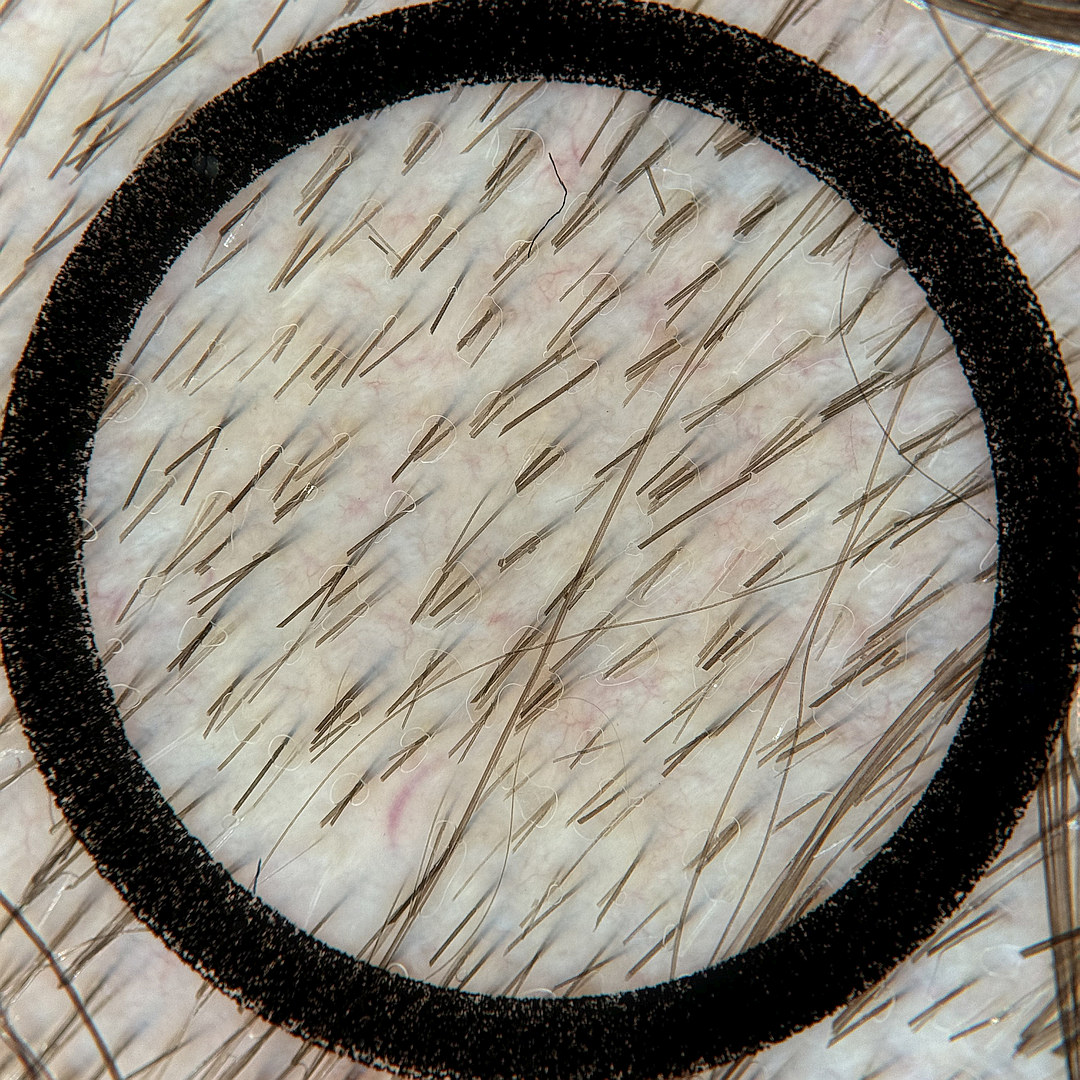 Ungeeignetes Beispielbild: ungekürzte Haare laufen quer durch das Bild